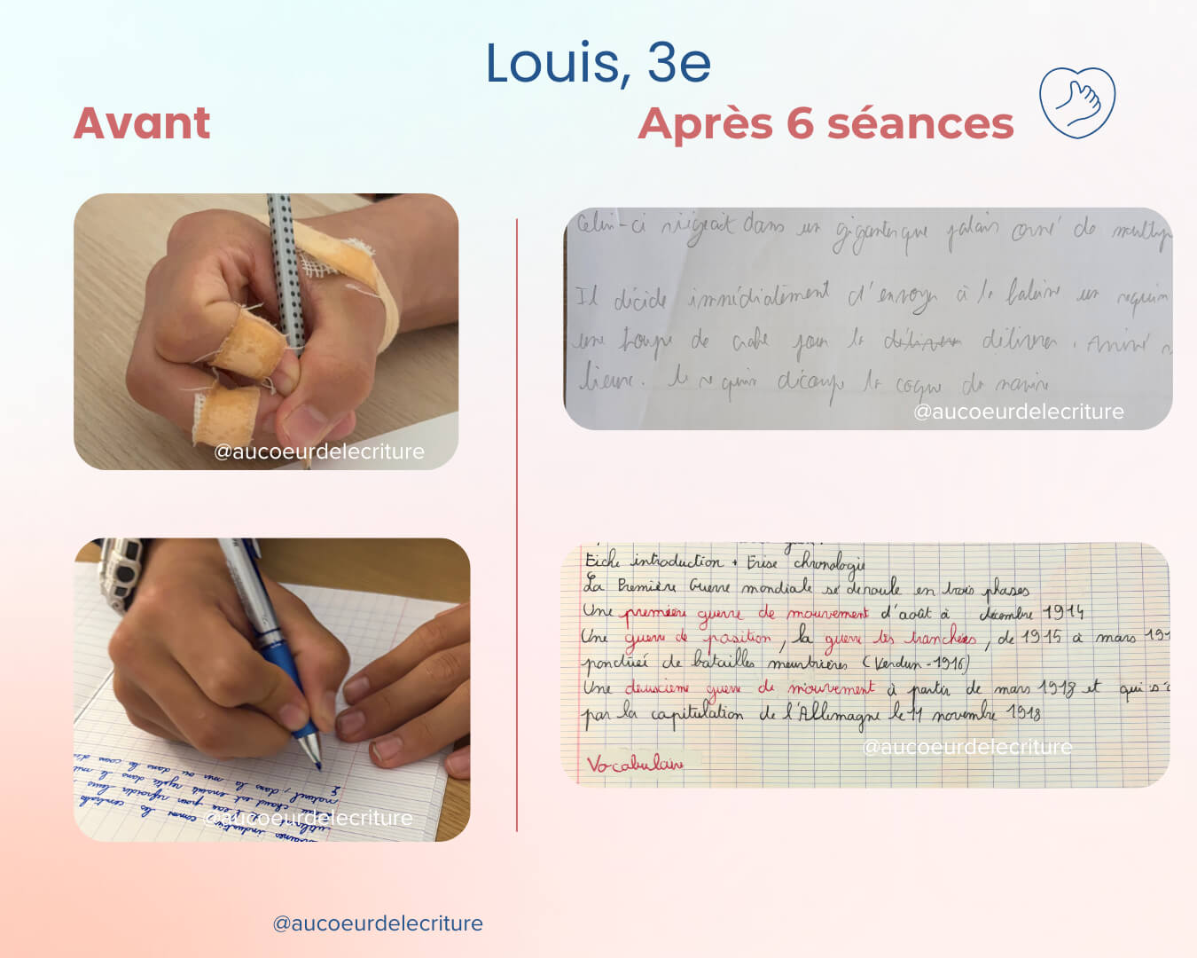 avant-apres-ecriture-tenue-crayon-louis-3e Les progrès en écriture de Louis, qui n'a plus de douleurs et écrit mieux.