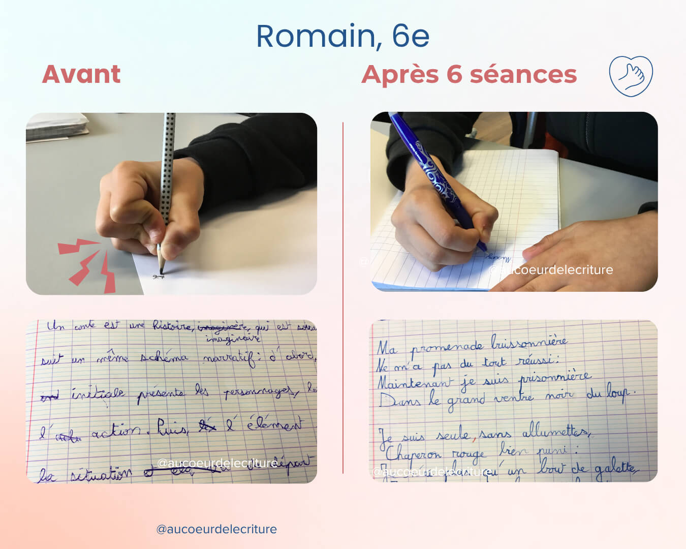 avant-apres-ecriture-tenue-crayon-romain-6e L'évolution de l'écriture de Romain, élève de 6e, qui n'a plus mal quand il écrit et son écriture est devenue plus lisible.